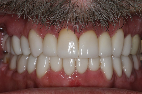 Katy Smile Design | Smile Makeovers, Emergency Treatment and Periodontal Treatment