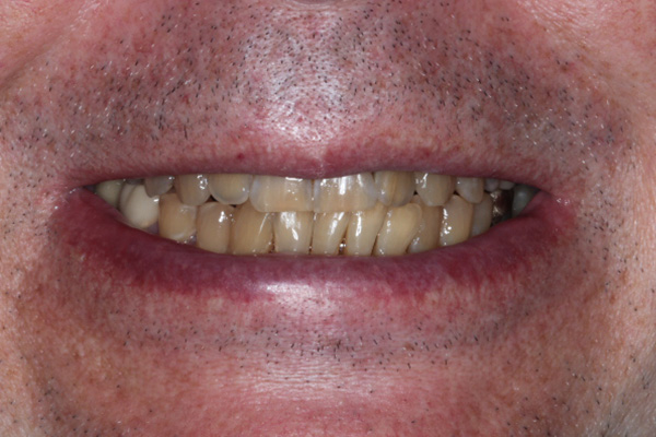 Katy Smile Design | Night Guards, Snoring Appliances and Digital Radiography