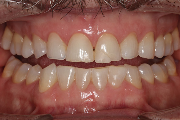 Katy Smile Design | Periodontal Treatment, Dental Bridges and Sedation Dentistry