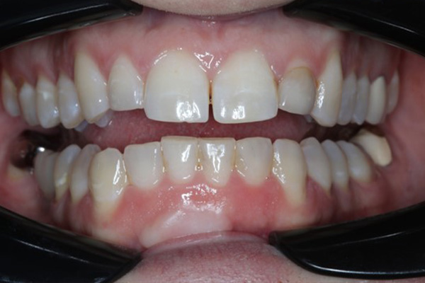 Katy Smile Design | Smile Makeovers, Periodontal Treatment and Oral Exams