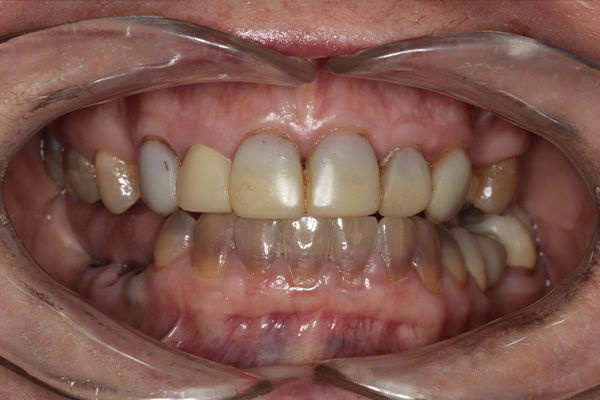 Katy Smile Design | TMJ Disorders, Sedation Dentistry and Laser Dentistry