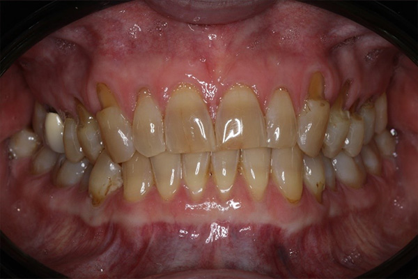 Katy Smile Design | Night Guards, Sedation Dentistry and Teeth Whitening