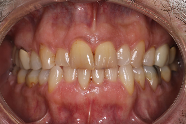 Katy Smile Design | Oral Cancer Screening, Digital Radiography and Cosmetic Dentistry