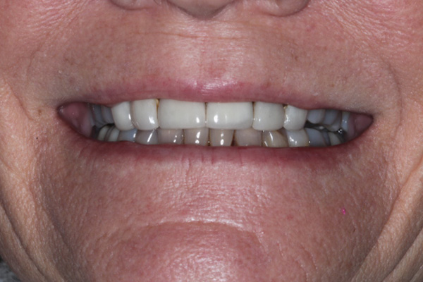 Katy Smile Design | Sedation Dentistry, Digital Radiography and Dental Bridges