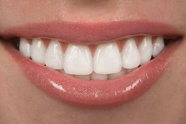 The image shows a close-up of a person s smiling face with white teeth, wearing lipstick, and the background is neutral in color.