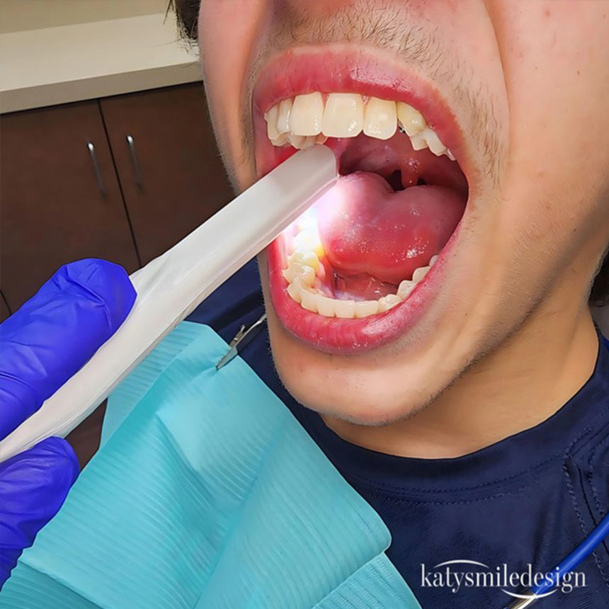 The image shows a person with an open mouth, holding a dental device, likely a dental mirror, while seated in front of a dental chair, wearing protective gloves and a blue surgical mask, and surrounded by dental equipment and supplies.