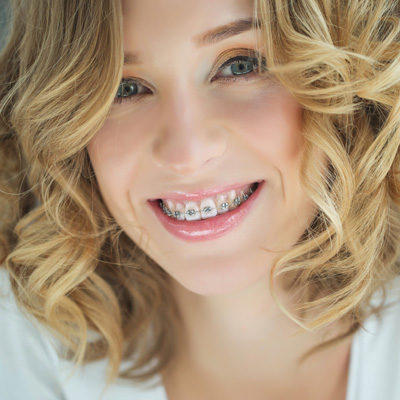 A smiling woman with braces, wearing a white top and light-colored hair, poses for a portrait.